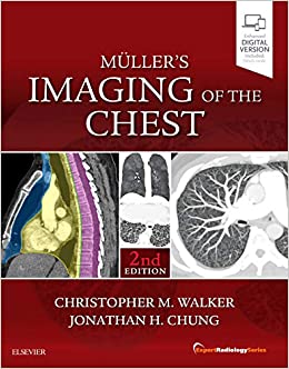 تصویربرداری از قفسه سینه: مجموعه رادیولوژی متخصص - رادیولوژی